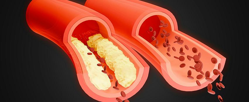 Cholesterol w prostych słowach: czym różni się „dobry” od „złego” i dlaczego warto to wiedzieć?